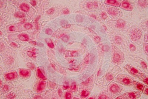 Root tip of Onion and Mitosis cell in the Root tip of Onion.