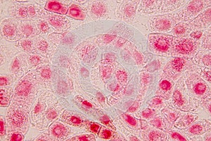 Root tip of Onion and Mitosis cell in the Root tip of Onion.