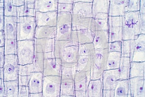 Root tip of Onion and Mitosis cell in the Root tip
