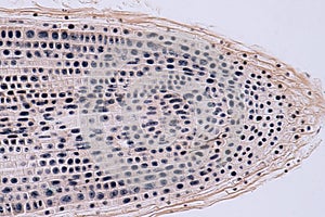 Root tip of Onion and Mitosis cell in the Root tip