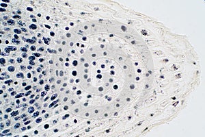 Root tip of Onion and Mitosis cell in the Root tip