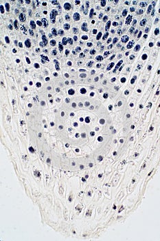 Root tip of Onion and Mitosis cell in the Root tip