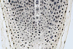 Root tip of Onion and Mitosis cell in the Root tip