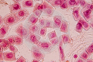 Root tip of Onion and Mitosis cell in the Root tip of Onion.