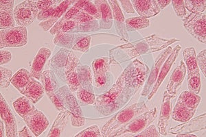 Root tip of Onion and Mitosis cell in the Root tip of Onion.