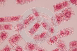Root tip of Onion and Mitosis cell in the Root tip of Onion.