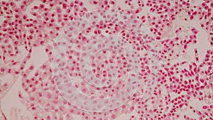 Root tip of Onion and Mitosis cell in the Root tip of Onion.