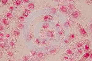 Root tip of Onion and Mitosis cell in the Root tip of Onion.