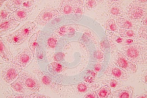 Root tip of Onion and Mitosis cell in the Root tip of Onion.