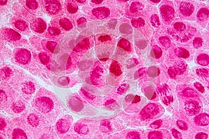 Root tip of Onion and Mitosis cell in the Root tip of Onion.