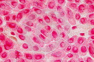 Root tip of Onion and Mitosis cell in the Root tip of Onion.