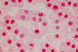 Root tip of Onion and Mitosis cell in the Root tip of Onion.
