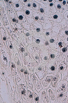 Root tip of Onion and Mitosis cell in the Root tip of Onion under a microscope.