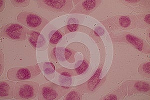 Mitosis cell in the Root tip of Onion under a microscope.