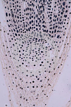 Root tip of Onion and Mitosis cell in the Root tip of Onion under a microscope.