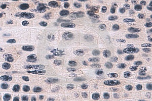 Root tip of Onion and Mitosis cell in the Root tip