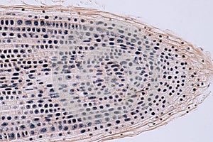 Root tip of Onion and Mitosis cell in the Root tip photo