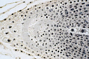 Root tip of Onion and Mitosis cell in the Root tip