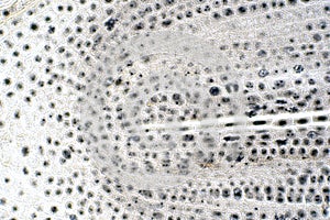 Root tip of Onion and Mitosis cell in the Root tip