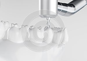 Root treatment with a drill closeup - 3D Rendering