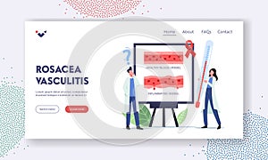 Rosacea Vasculitis Landing Page Template. Tiny Doctor Characters with Huge Thermometer Stand at Infographics Aid