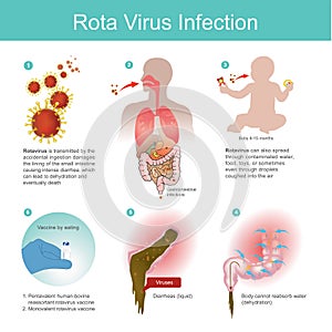 Rotavirus is transmitted by the accidental ingestion.it then da