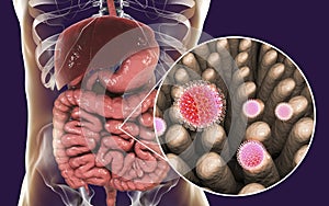 Rotaviruses in small intestine