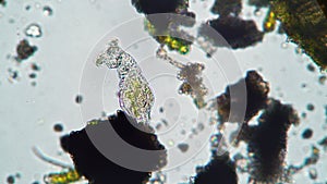 The rotifer feeds by filtering fresh water close up under a microscope