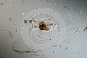 Rotifer foraging