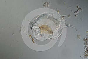 Rotifer foraging