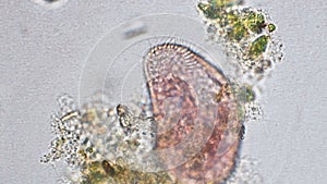 Rotifer magnification at optical microscope