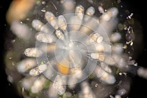 Rotifer under the microscope .