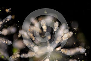 Rotifer under the microscope .