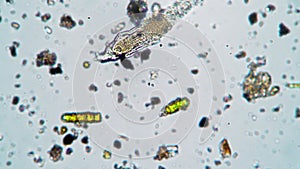 The rotifier is crawling in the water trying to move under the microscope