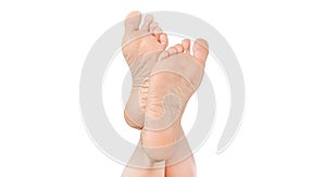 Rough skin on soles of feet. dry heels, dry chapped skin on feet requiring care isolated on white background, dry skin on heels