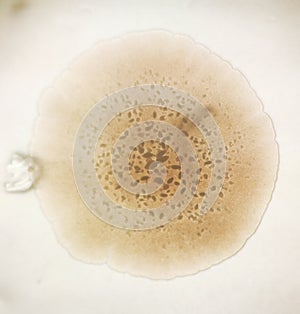 A round shaped bacterial colony under the optical microscope