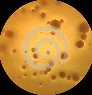 Round shaped candida albicans colonies under the microscope