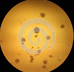 Round shaped candida albicans colonies under the microscope