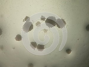 Round shaped candida albicans colonies under the microscope