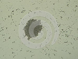 Round shaped candida albicans colony under the microscope