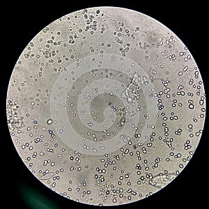 Round thick wall yeast cell