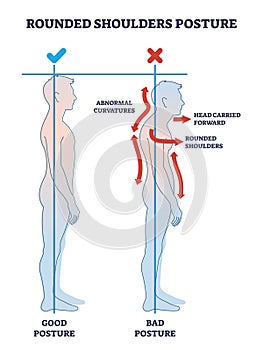 Rounded shoulders posture with body alignment forward outline diagram