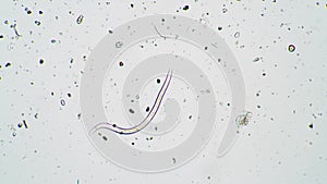Roundworm nematode moves in fresh water under a microscope close up