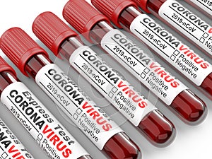 Row tubes with blood samples for Coronavirus test COVID-19 - virus protection concept
