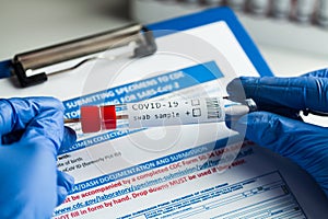 Rt-PCR COVID-19 virus disease diagnostic test