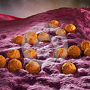 Rubella - German measles