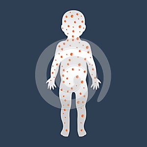 Rubella German Measles logo icon design photo