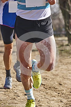 Runner with vitiligo disease on a cross crountry race. Skin disorder