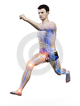 A runners painful joints