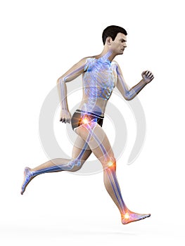 A runners painful joints